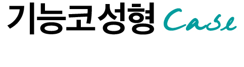 기능코성형case